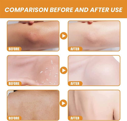 Orange Zyme Deep Clean Gel – Soft & Bright Skin Solution